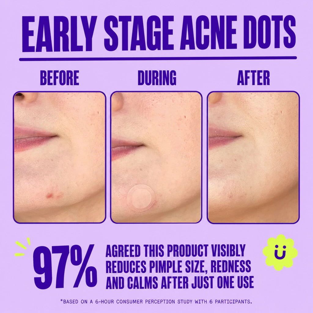 Pimple patches