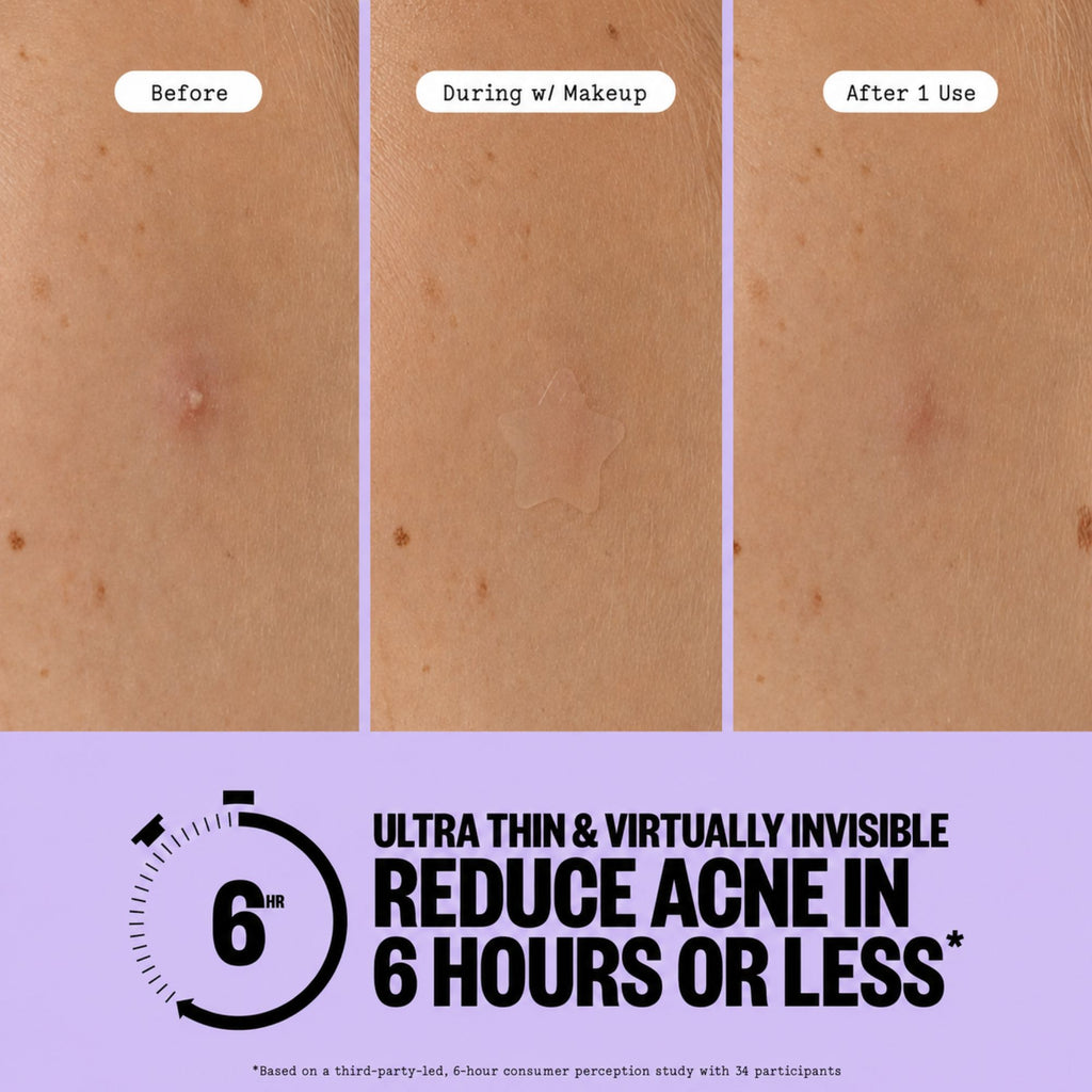 Hydrocolloid Star Patches