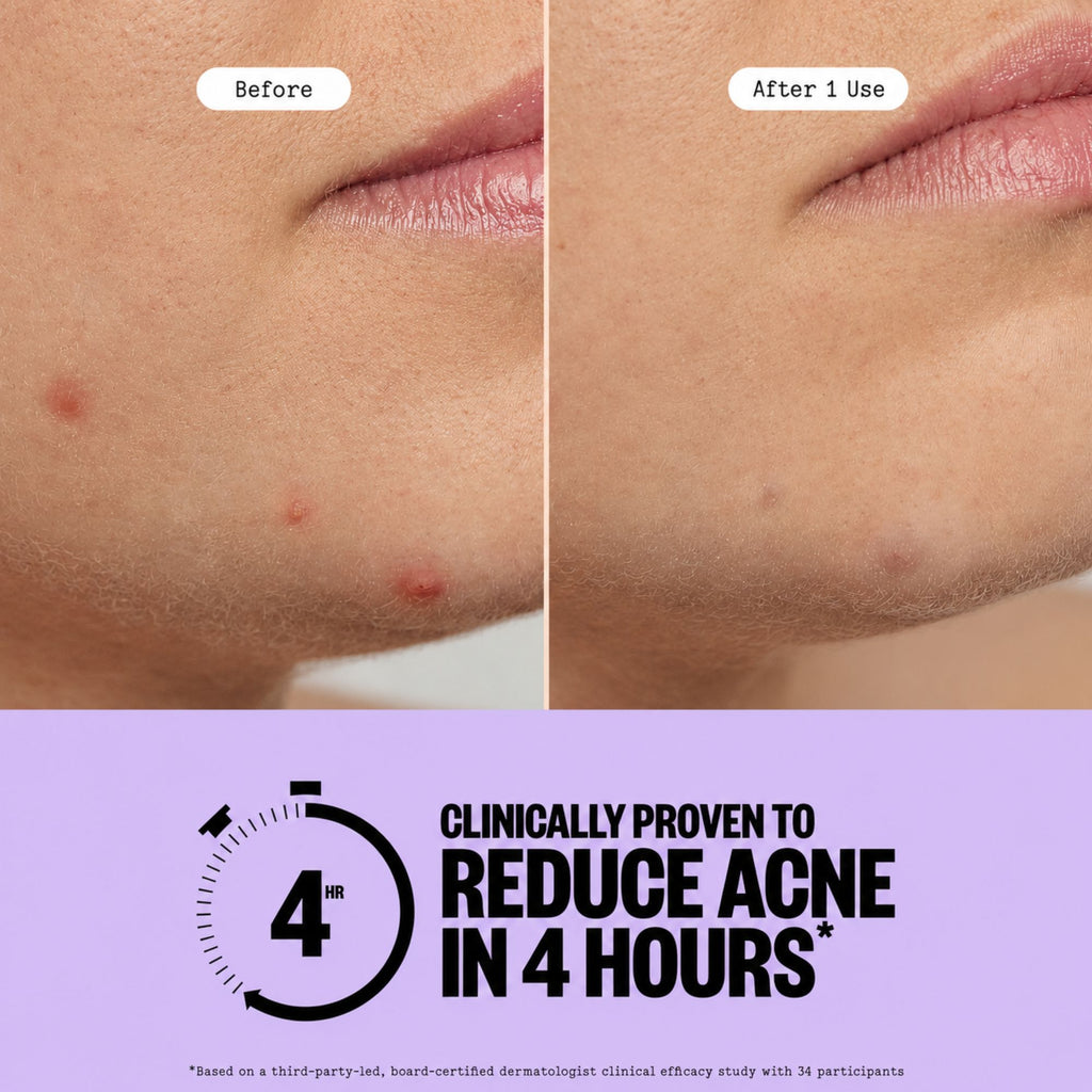 Hydrocolloid Star Patches