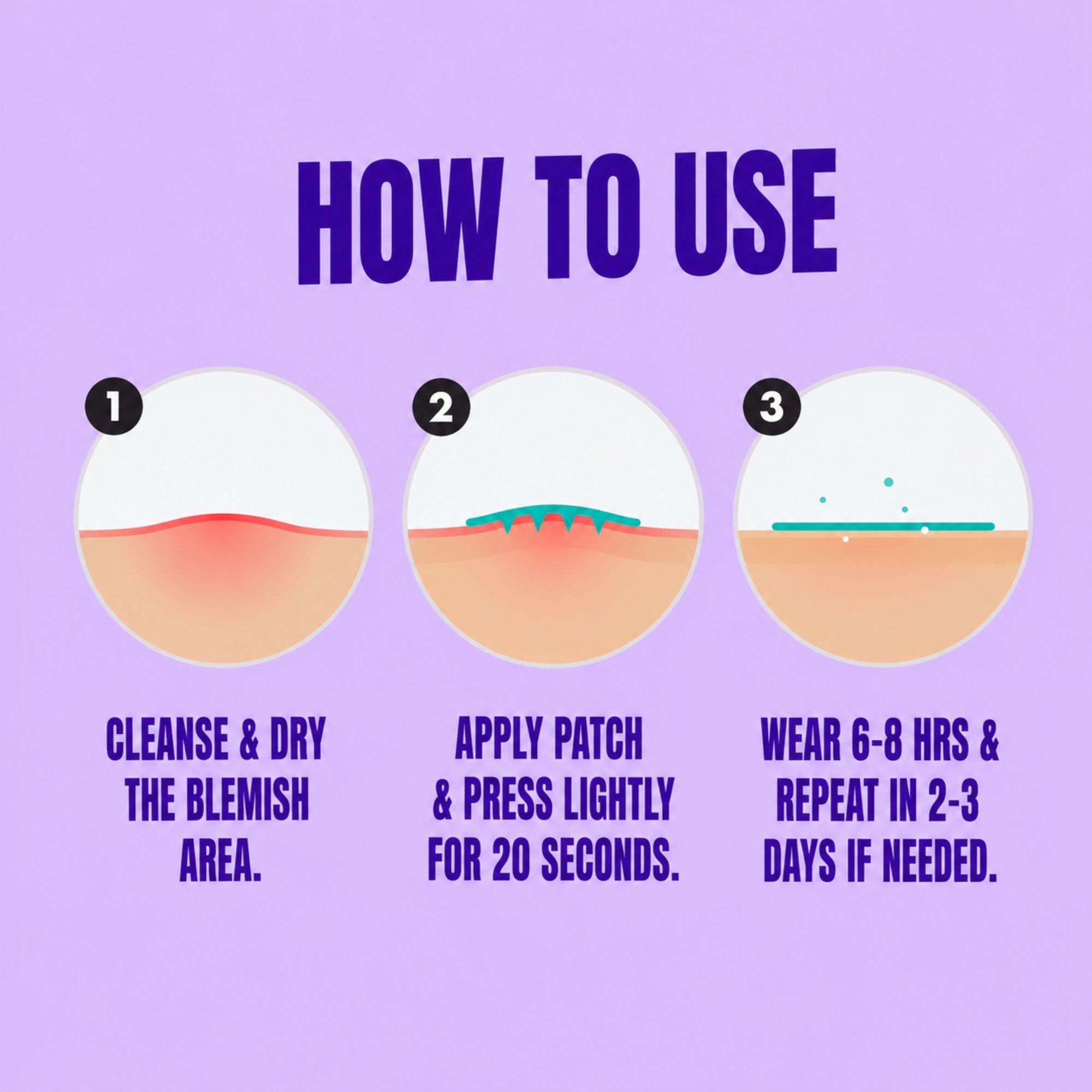 Pimple patches