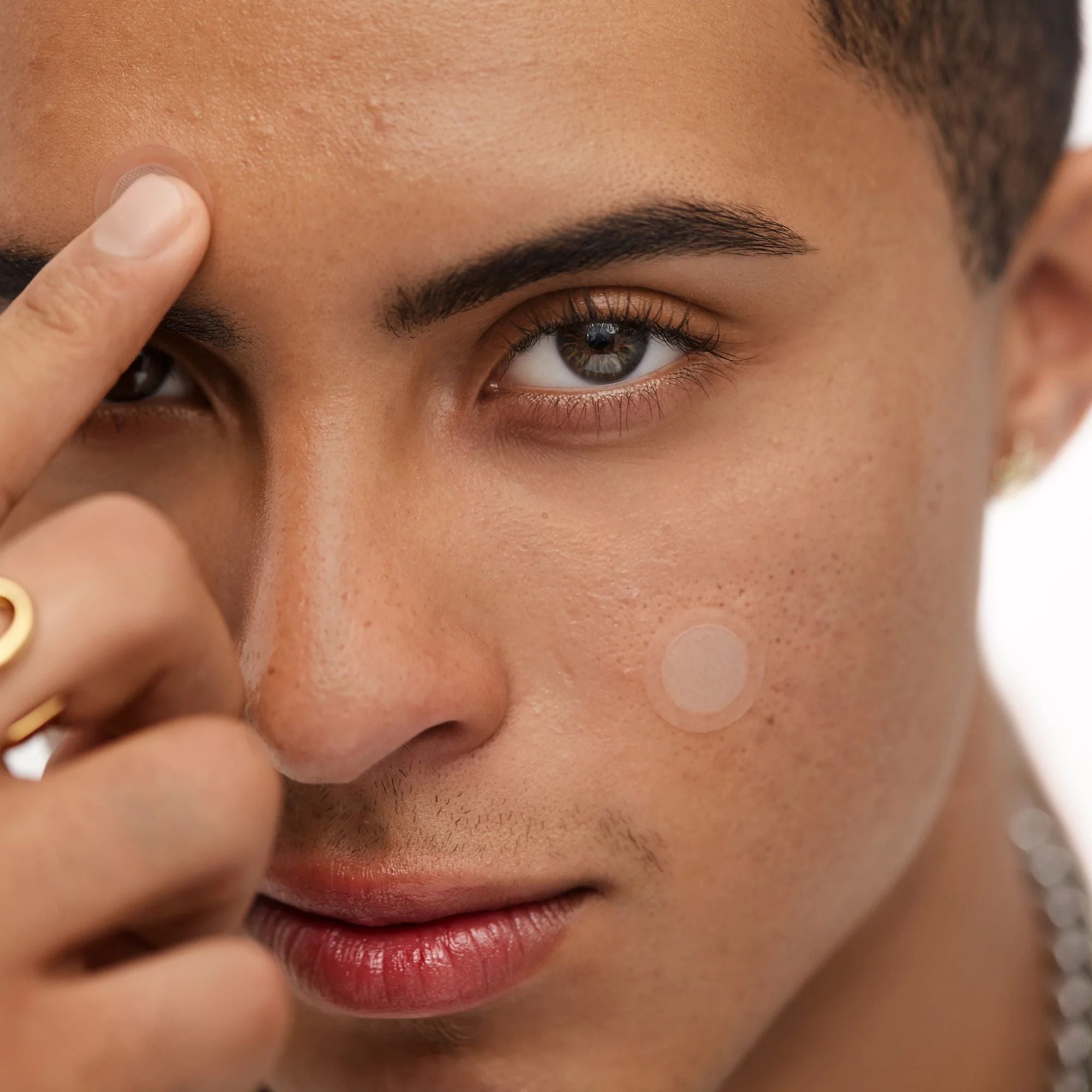 Pimple patches